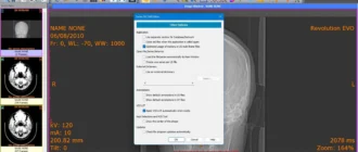 Aktivatsiya Sante Dicom Editor 10.2.0.webp