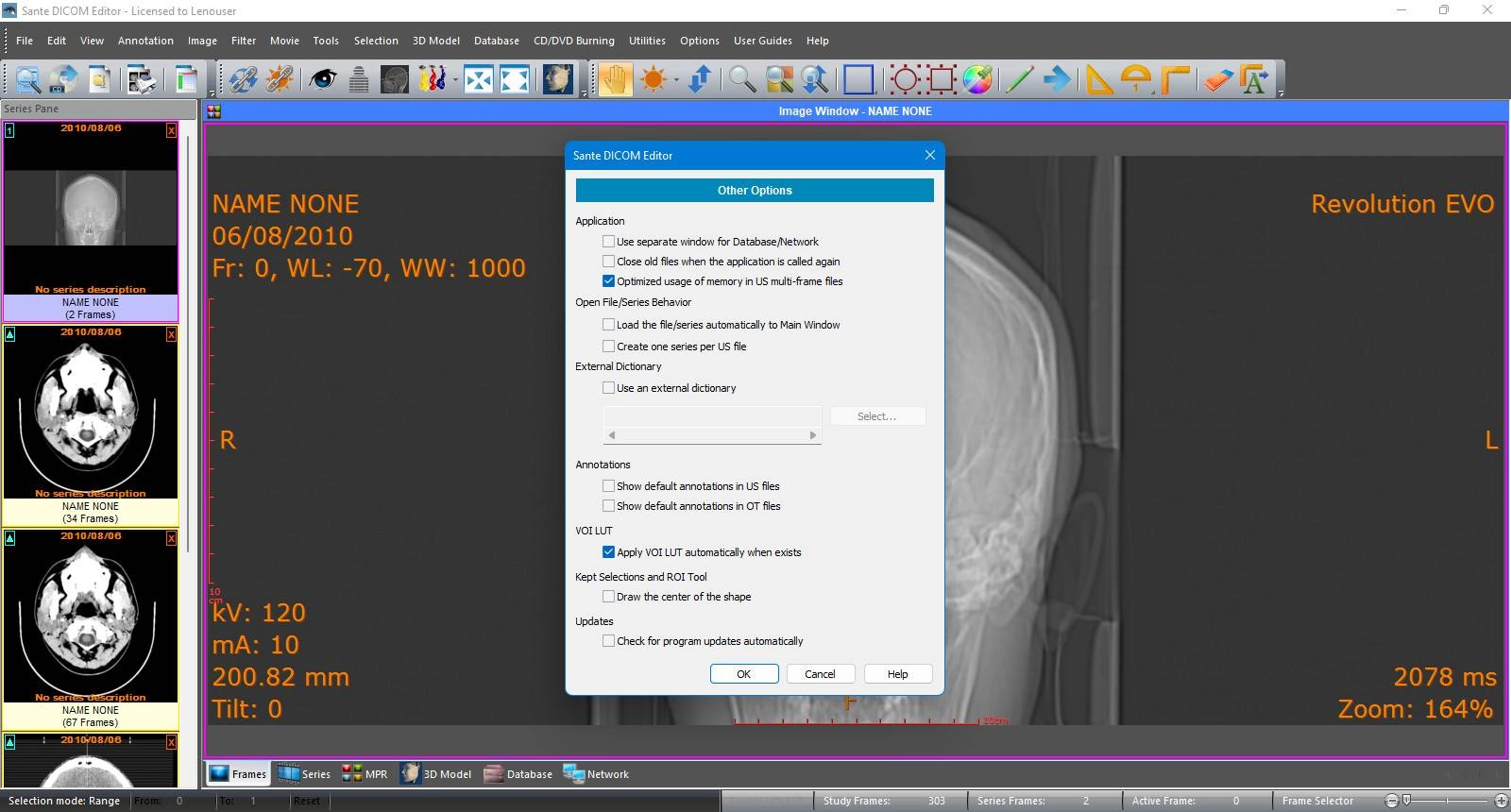 Aktivatsiya Sante Dicom Editor 10.2.0.webp