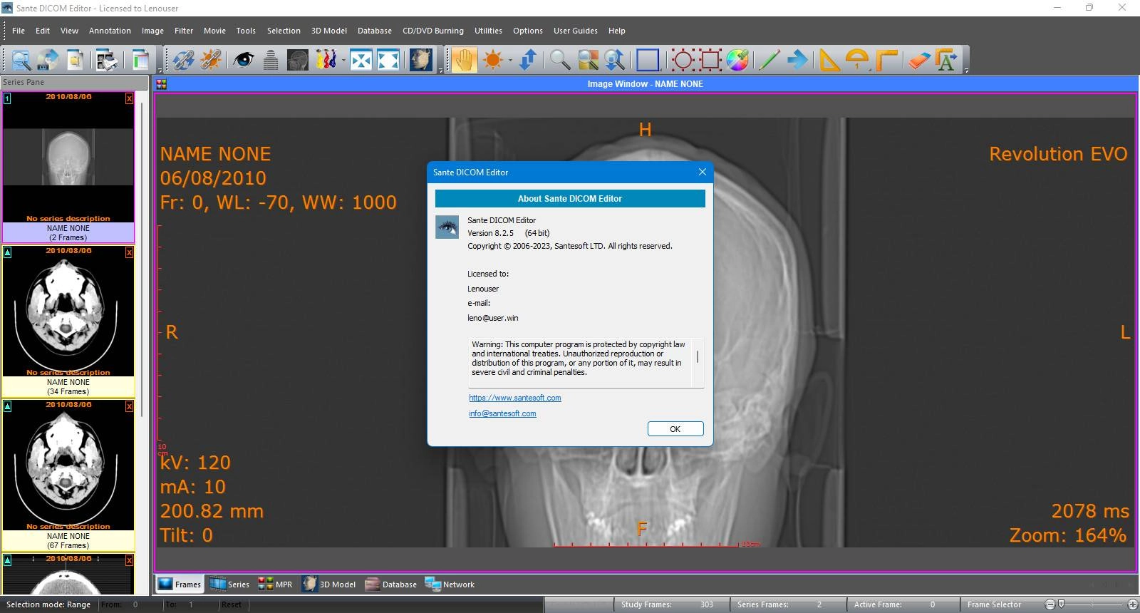 Активация Sante DICOM Editor 10.2.0