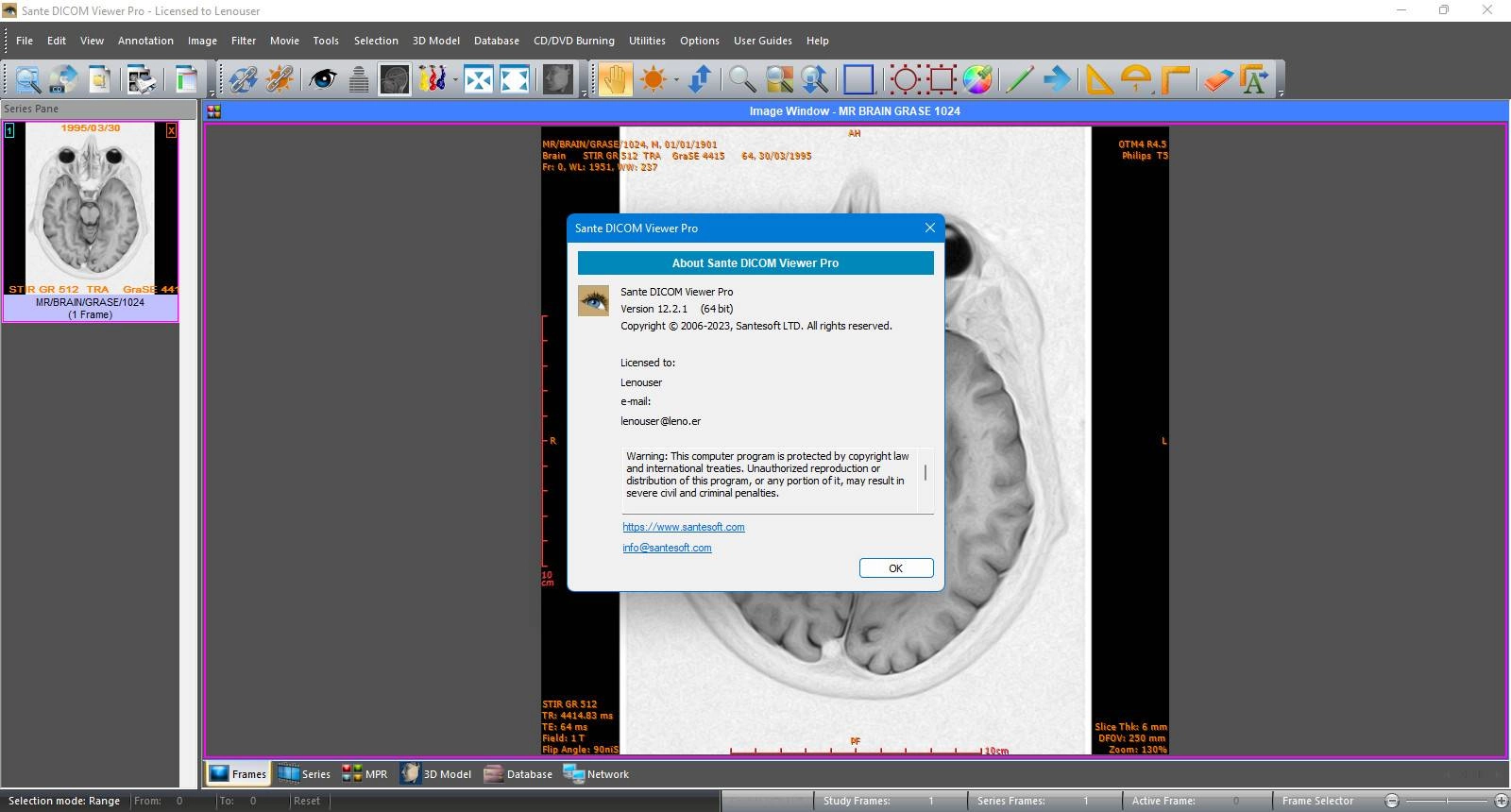 Активация Sante DICOM Viewer Pro 14.2.0