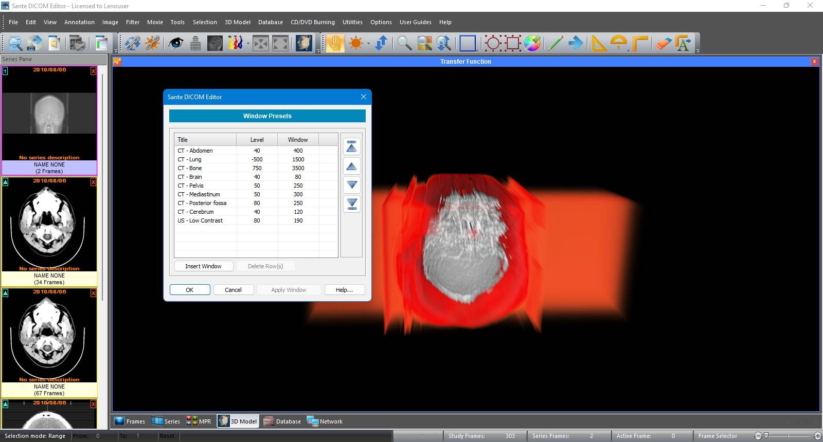 Как пользоваться Sante DICOM Editor 10.2.0