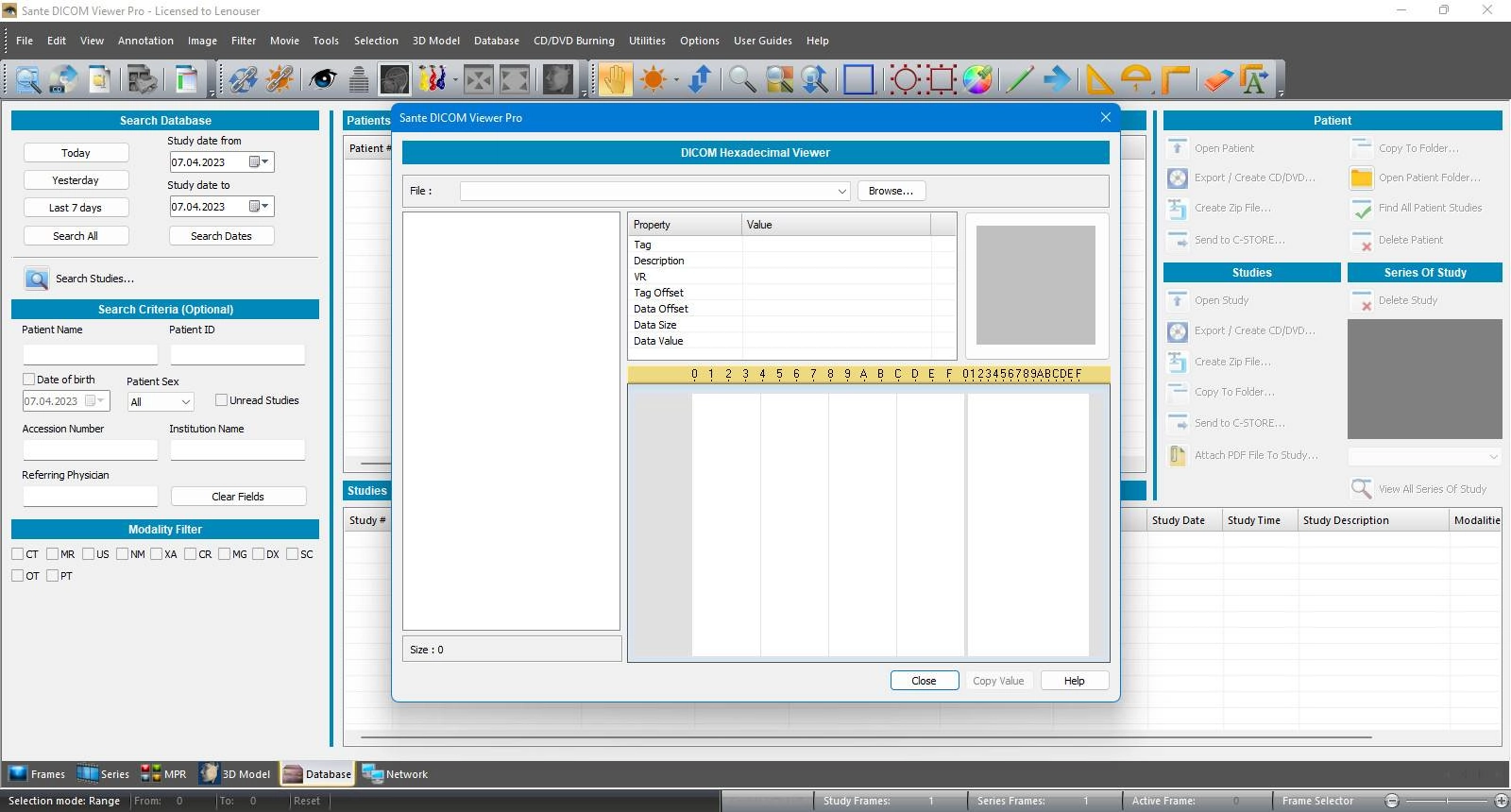 Как пользоваться Sante DICOM Viewer Pro 14.2.0